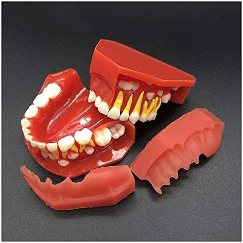 Модел орган YUESFZ Модел на Пасти за зъби - Чередующаяся Модел на Млечните Зъби Модел Детски Млечни Зъби Имитация на Орален на Зъба,